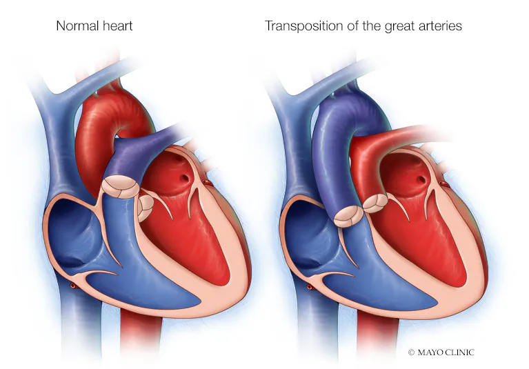 Dr. Pradeep Pokharna – MICS Expert in Indore