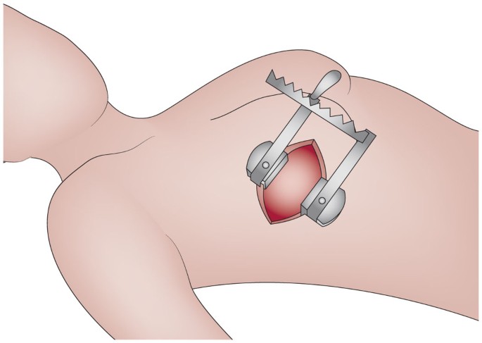 Heart Specialist in Indore - pediatric cardiac surgery (if applicable)