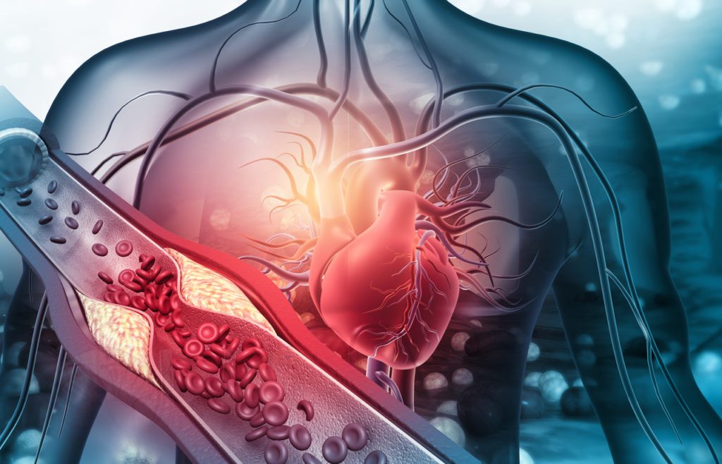 Heart Specialist in Indore - vascular surgery